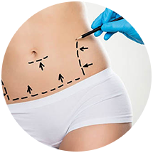 chirurgie-du-corps