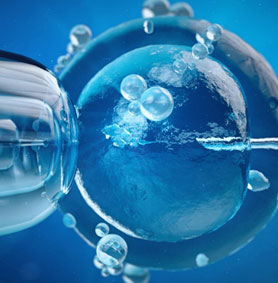insemination-artificielle